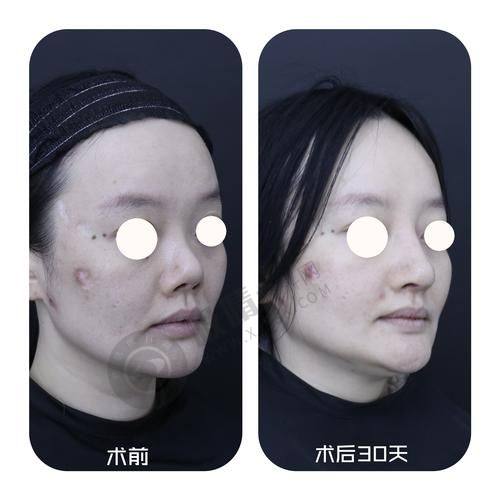 4. 杭州奥拉克医疗美容的服务和口碑好不好？