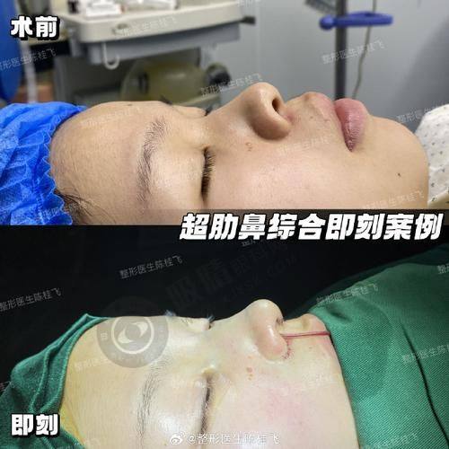 3. 杭州清沐医疗美容门诊部的医生团队怎么样？