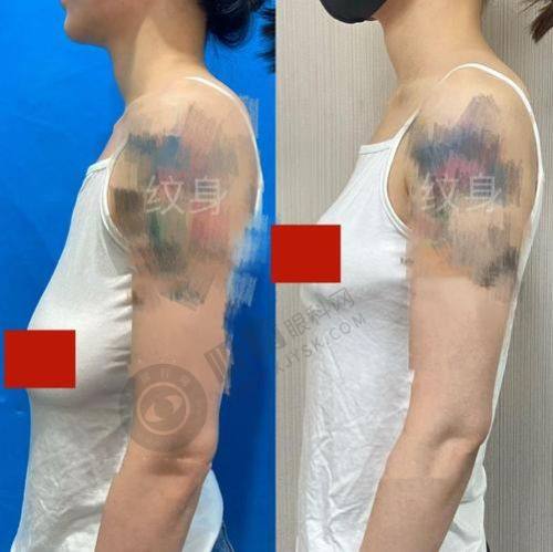 2. 杭州清锴医疗美容门诊部的医生团队怎么样？