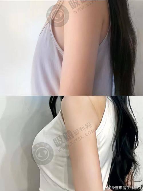 3. 宁波菁漾轻医美有哪些特色项目？