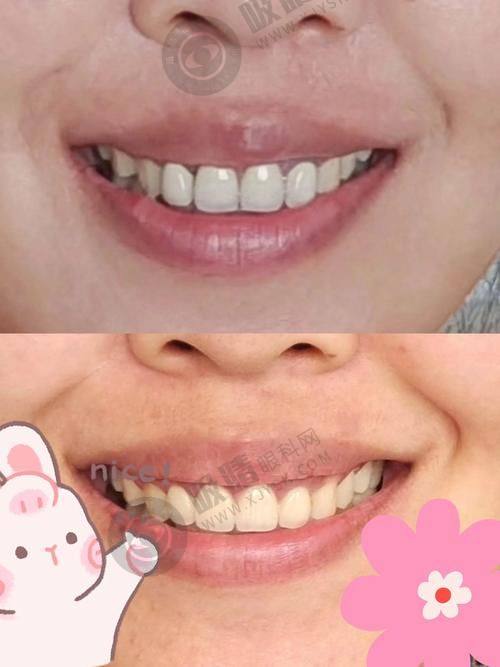 6. 宁波余姚三禾口腔的口碑究竟如何？
