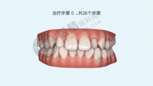 3. 嘉兴唯美口腔门诊部的收费情况怎样？