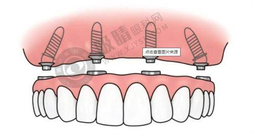 4. 杭州淳安雅正口腔门诊部服务怎么样？