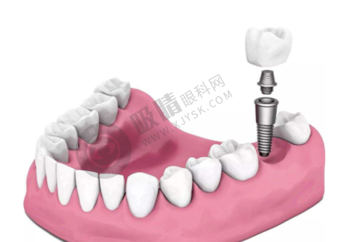 1. 嘉兴唯美口腔门诊部有哪些精良技术？