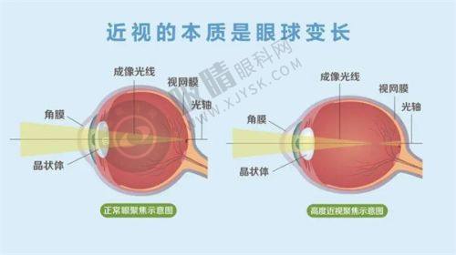 三、郑州尖峰眼科医院的价格情况如何?