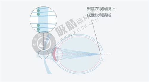 三、郑州博爱眼科全飞秒价格是多少？