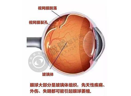 郑州尖峰眼科医院正规吗？全飞秒手术低至9800元起，德国蔡司设备保障安全