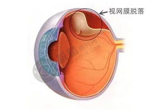 郑州全飞秒手术价格大揭秘，华厦视光眼科1.8万起+德国蔡司设备保障安心摘镜！