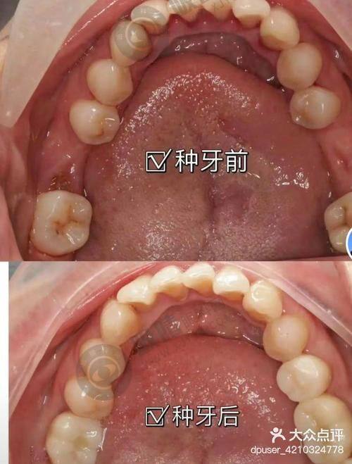 1. 杭州盈盈口腔连锁的品牌实力如何？