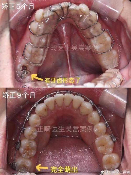 4. 江门简牙口腔医院的服务有什么特色？