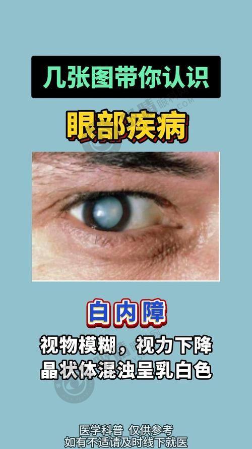 四、除了全飞秒，郑州尖峰眼科医院还有哪些眼科项目？