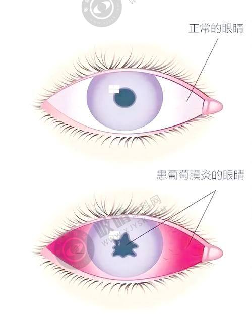 一、郑州奥弗克眼科医院正规性体现在哪？