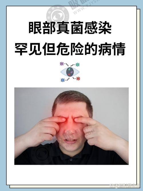 四、选择郑州视光眼科华厦有什么好处？