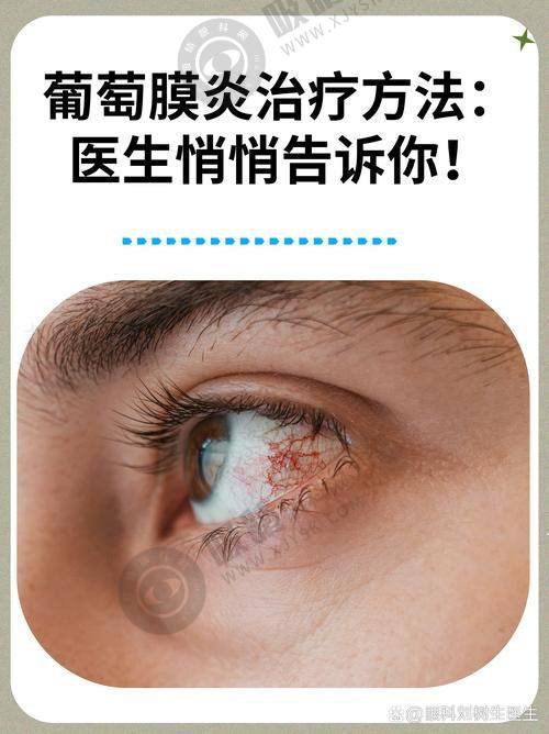 三、郑州白内障手术费用及免费政策是怎样的？