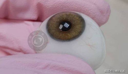 郑州美视美康眼科医院的价格贵吗？