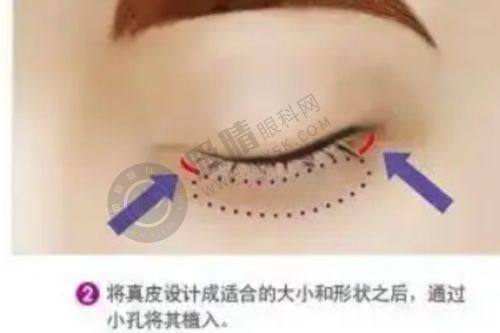 嘉兴韩辰医疗美容靠谱吗？明星同款
