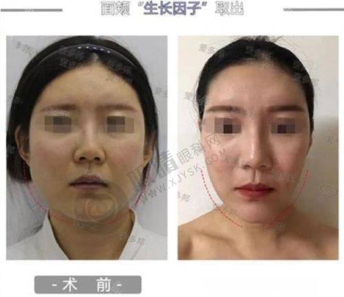 5. 重庆艺星美容医院——综合治疗，术后管理贴心