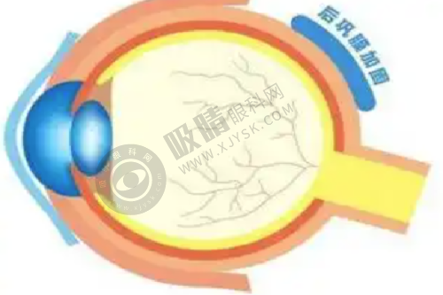 郑州美莱整形怎么样？眼鼻整形高评分口碑，德国水雕吸脂+核心锚定隆鼻技术解析！