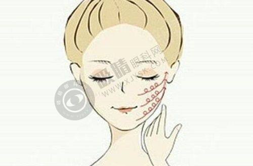 4. 郑州芳华医疗美容的项目价格如何？