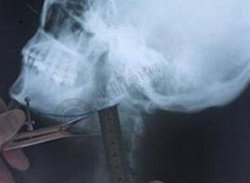 3. 郑州喜丽整形医院的服务和环境如何？