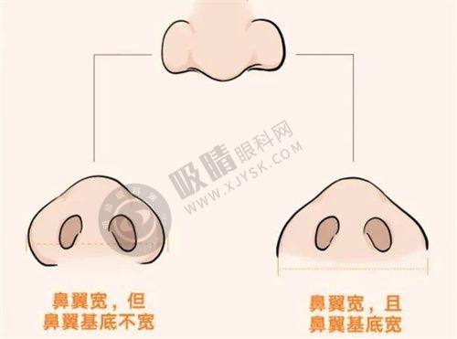 2. 郑州丽人整形的技术优势体现在哪里？