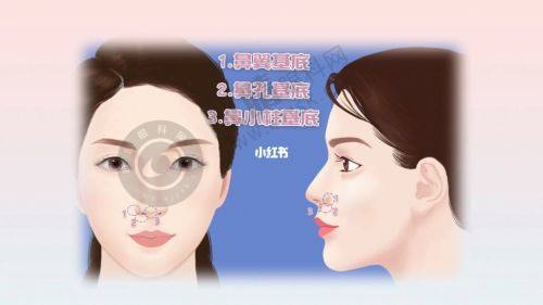 2. 郑州科大医院私密科的技术优势体现在哪？