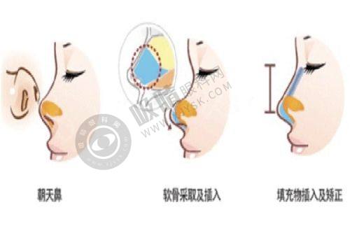 总结