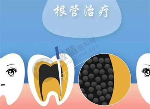 郑州德韩口腔是公立还是私立？揭秘其私立优势：种植牙4680元起+当天种牙当天啃苹果！
