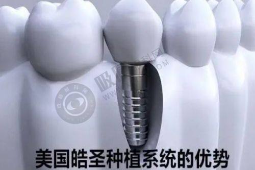 广州穗华口腔正规靠谱吗？暨大附属、数字化种植3999起、硕博医生团队实力解析！