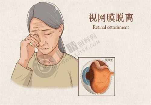 焦作尖峰眼科医院收费标准