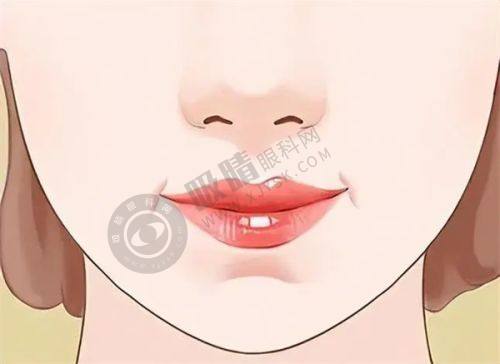 3. 郑东美遇医疗美容的紧缩针注射项目怎么样？