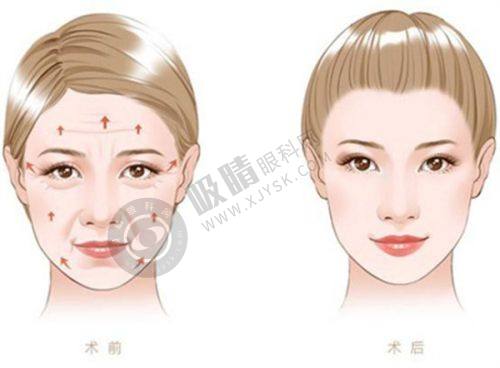 郑州清禾原素整形靠谱吗？3D动态缝合+9D原生鼻技术解析，高自然满意度见证实力！