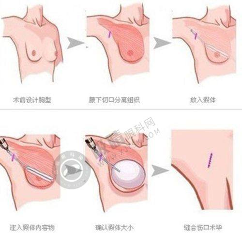 杭州天鑫整形医院的热门项目有哪些？
