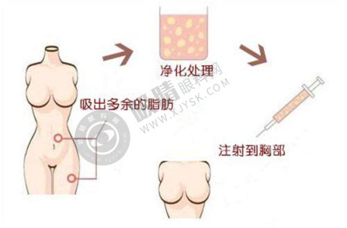 重庆美仑美奂整形医院值得信赖