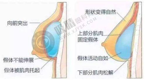 郑州市管城中医院整形科正规吗？30年公立二甲资质、改良Park双眼皮技术，安全变美有保障！