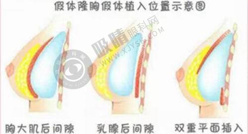 4. 浙江慈溪圣爱医院的服务质量怎么样？