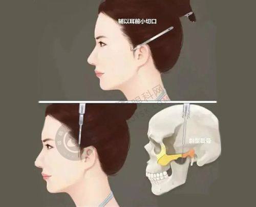 3. 郑州芳华医疗美容的医生团队怎么样?