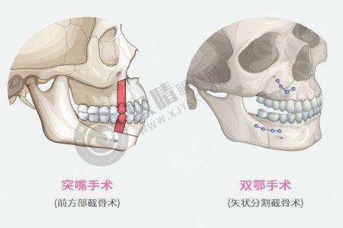 淄博阳光整形美容医院——老牌医美机构的不错技术