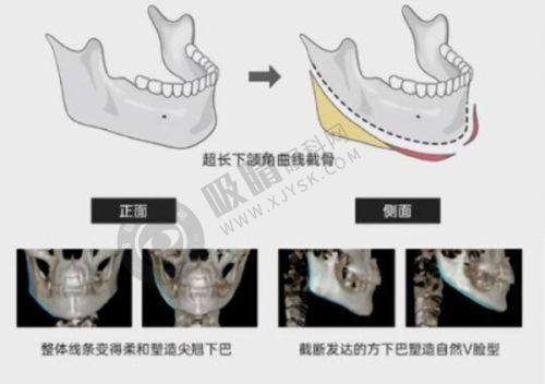 2. 重庆美莱医疗美容医院——技术精良，个性化定制套餐