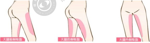 郑州缔莱美整形医院的医生团队怎么样？