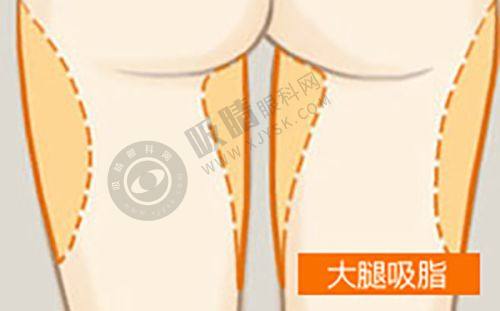 4. 郑州汴美整形的口碑怎么样?