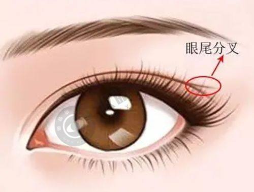 4. 消费者选择郑州曙光植发的原因有哪些?