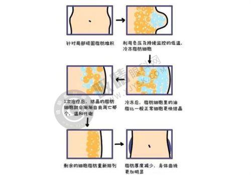 2. 郑州悦容整形医院的技术和设备优势体现在哪里?