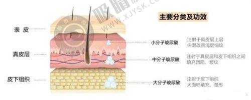 2. 郑州曙光植发的技术优势体现在哪里?