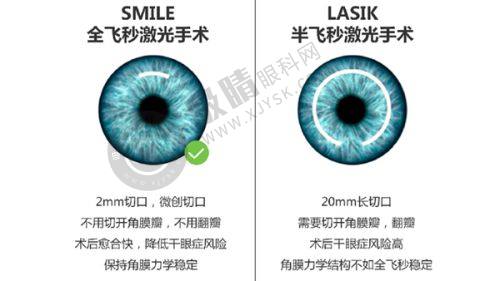 不同手术方式下合肥后巩膜加固价格表