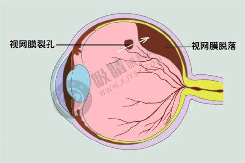 广西视光中 心医生在线，答疑解惑