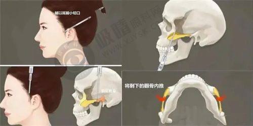 2. 浙江慈溪圣爱医院的整形技术和设备怎么样？
