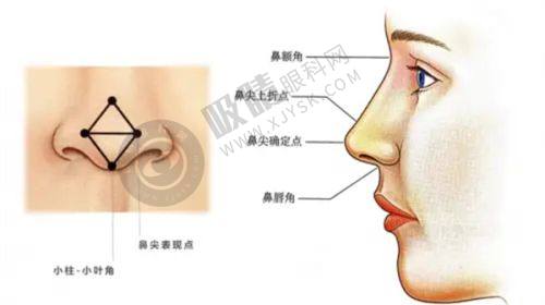 3. 郑州艺德雅整形的项目价格如何？
