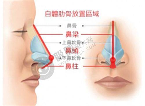 2. 门诊部的眼部整形项目有什么特点？