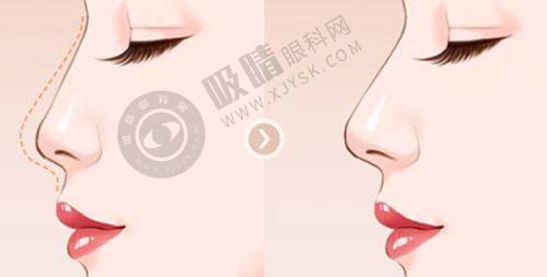 杭州妍醍医疗美容靠谱吗？轻医美专家一对一定制方案，注射塑形+光子嫩肤效果惊艳！